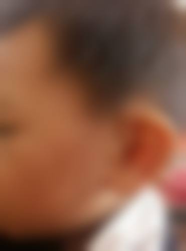 六、成都锦一医院皮肤美容科怎么预约：