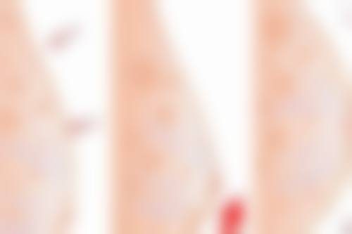 四、武汉都市女子整形医院实例