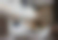 福州台江海峡美容医院何俊杰医生手术实例成效