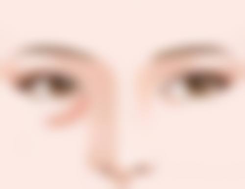 眼袋手术后如何快速消肿？伤口护理不能忘