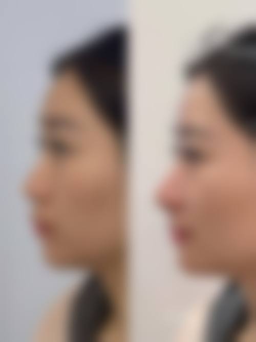 八、北京美清整形医院真实的顾客评价如下：