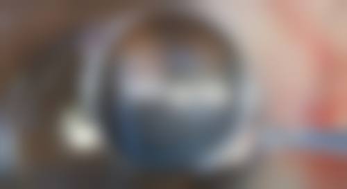 假体隆胸喂奶究竟会不会下垂？年龄因素也有影响