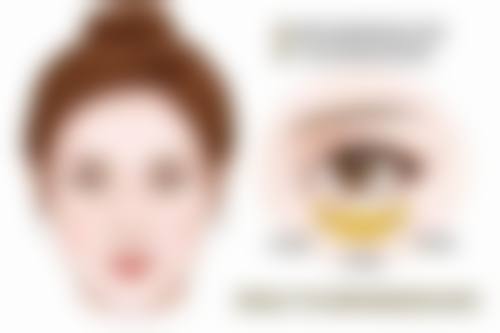 甲状腺手术疤痕何时增生？一般1 - 3个月开始，3 - 6个月硬度达高峰及应对方法揭秘 