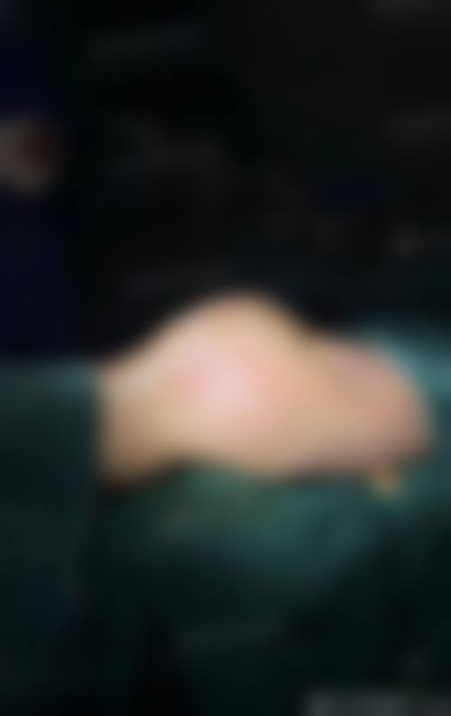 五、佛山市妇幼保健院皮肤美容科实例