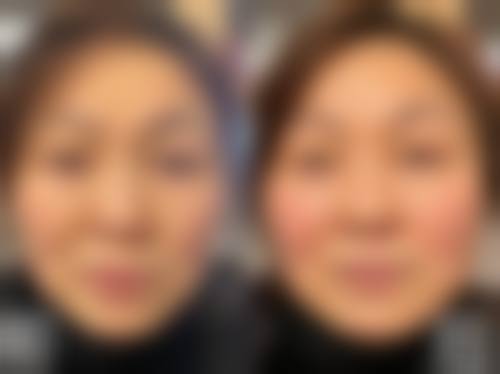 六、甘肃省兰州市崔大夫博士丽整形美容门诊部怎么预约: