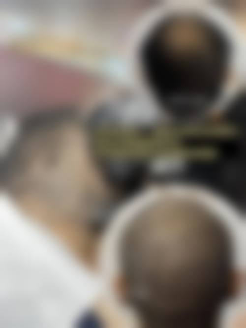 五、庆阳沐森植发医院实例