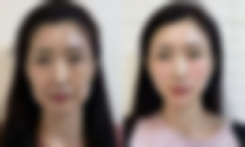 八、日本衣理美容外科医院真实的顾客评价如下：