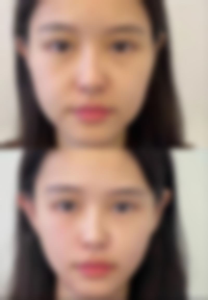 五、日本衣理美容外科医院实例