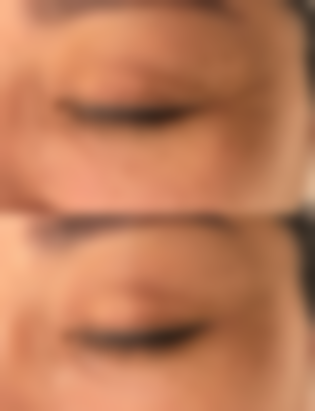 五、丽江周芸竹靓整形美容诊所实例