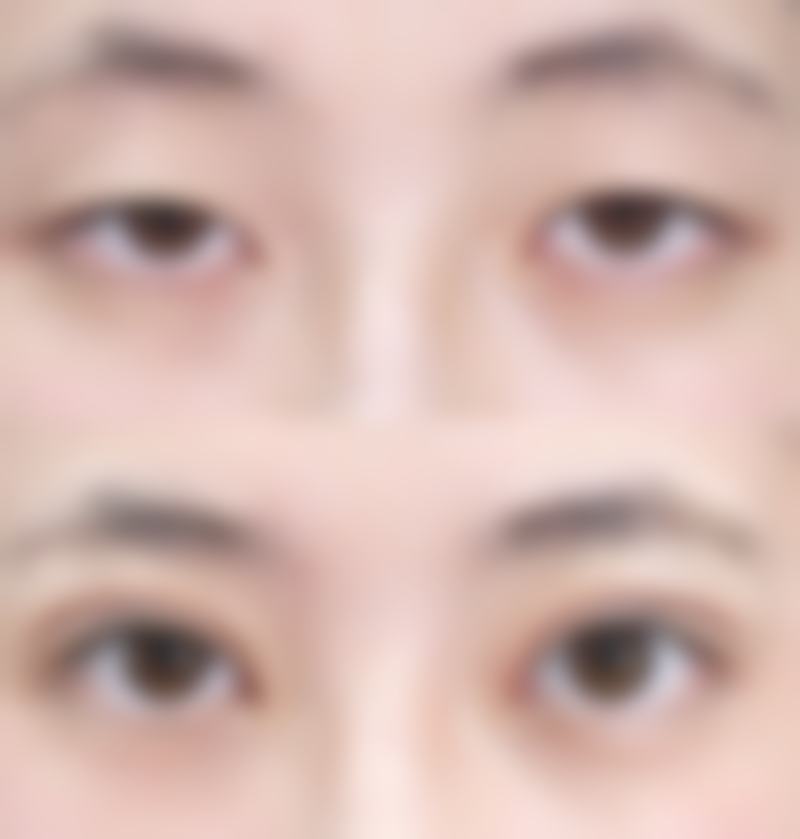 五、甘肃省兰州市崔大夫博士丽整形美容门诊部实例