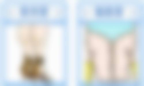 易湘豪医生口碑和评价