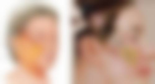 锁骨骨折手术疤痕修复的通用注意事项