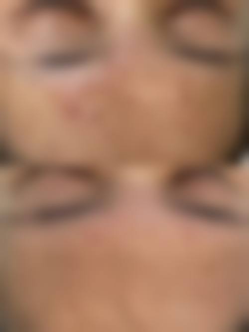 八、新乡医学校第一附属医院皮肤性病科真实的顾客评价如下: