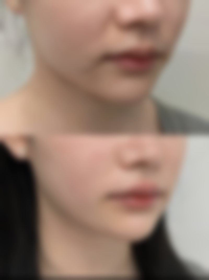 易湘豪医生怎么样可靠吗？