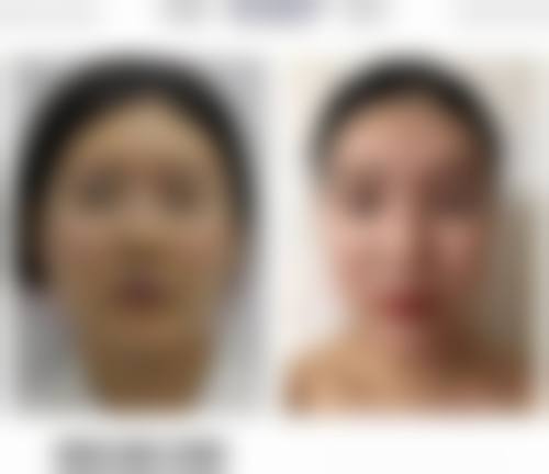 日常护理,巩固治疗成效的“小秘诀”