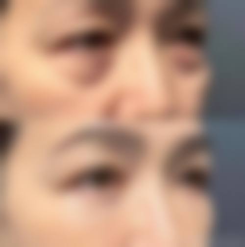 六、昆明延安医美整形怎么预约：