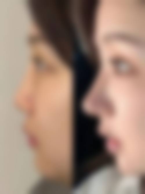 八、锡林浩特泽颜整形医院真实的顾客评价如下：