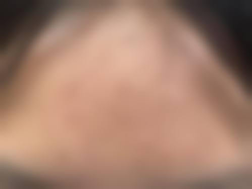 田博医生口碑和评价