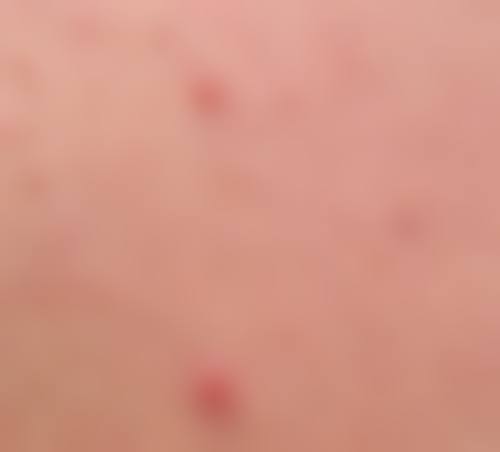 五、深圳德至医疗美容诊所实例