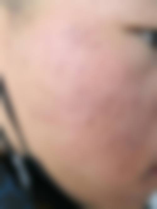 六、深圳德至医疗美容诊所怎么预约：