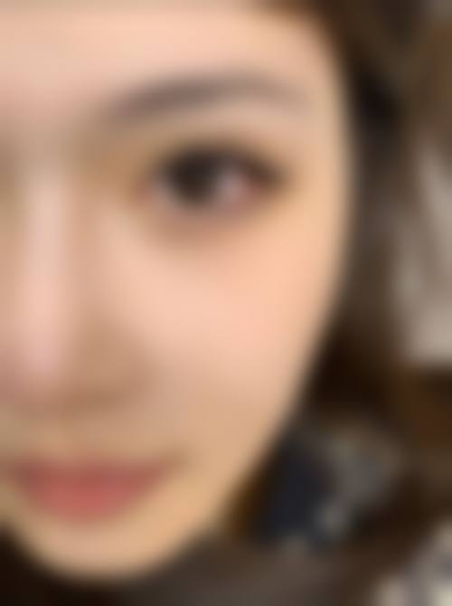 五、章丘市中医医院整形美容烧伤治疗中 心实例