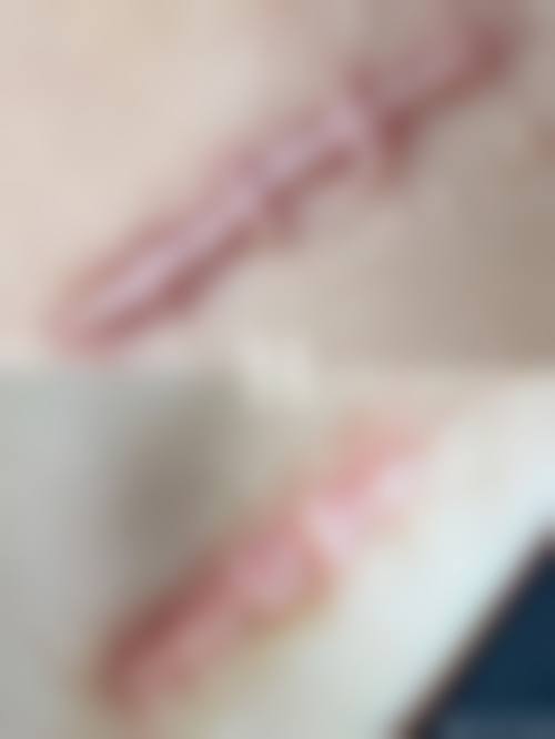 贺吉庸医生实例