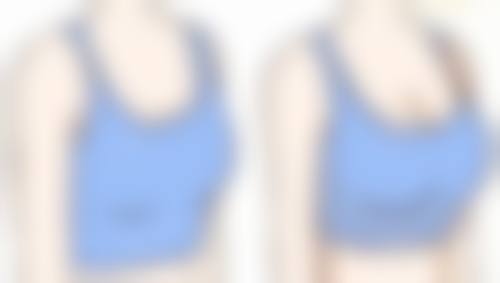 吸脂肪的优势有哪些?多技术联合带来的惊喜