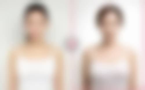 八、深圳明伦整形医院真实的顾客评价如下：