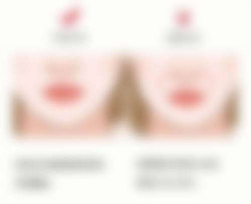 割双眼皮后修复，常见方式有哪些