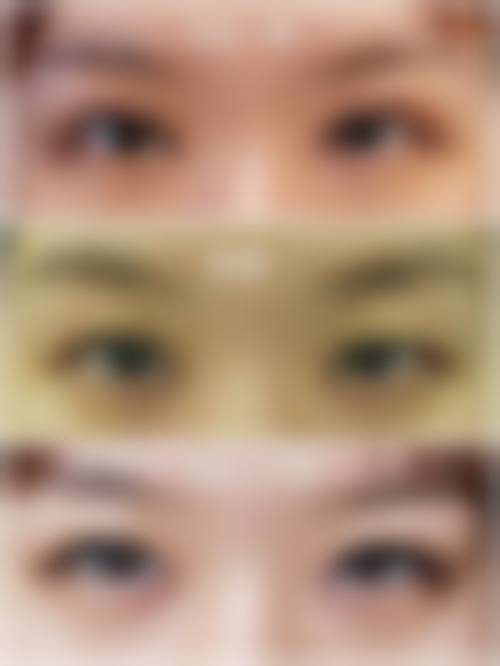 五、北京米扬丽格整形医院实例