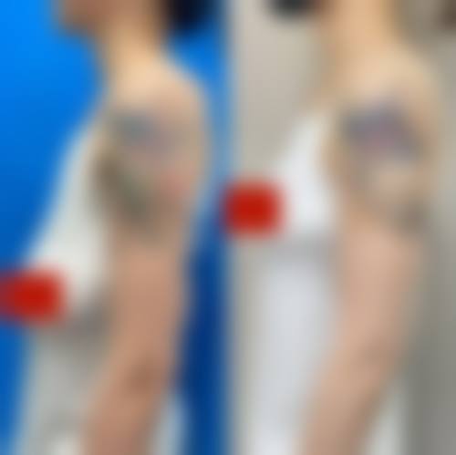 五、徐州王医生美容整形医院实例