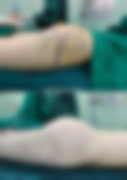 七、北京米扬丽格整形医院价格表：（仅供参考）