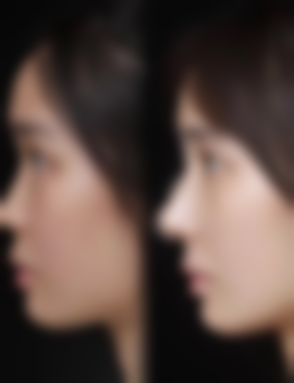 六、深圳明伦整形医院怎么预约：