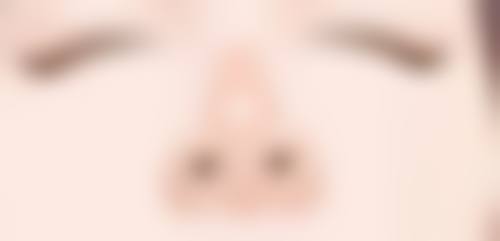 烫伤留下的疤痕能否消掉?日常护理特别重要