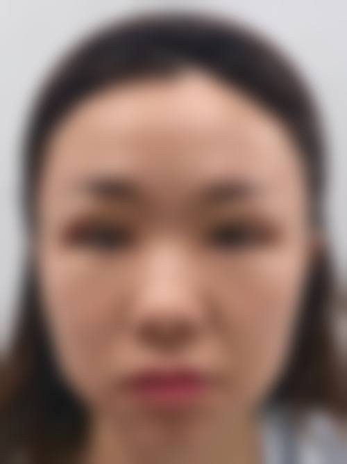 周克林医生在哪家医院怎么预约?