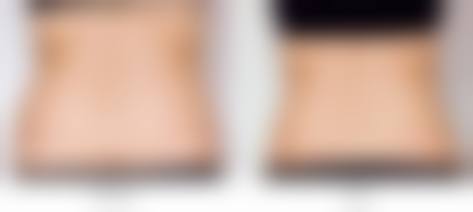 七、历下轻奢整形医院真实的顾客评价如下：