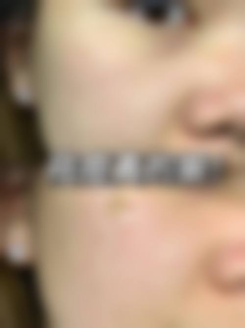 片桐衣理医生项目价格表参考