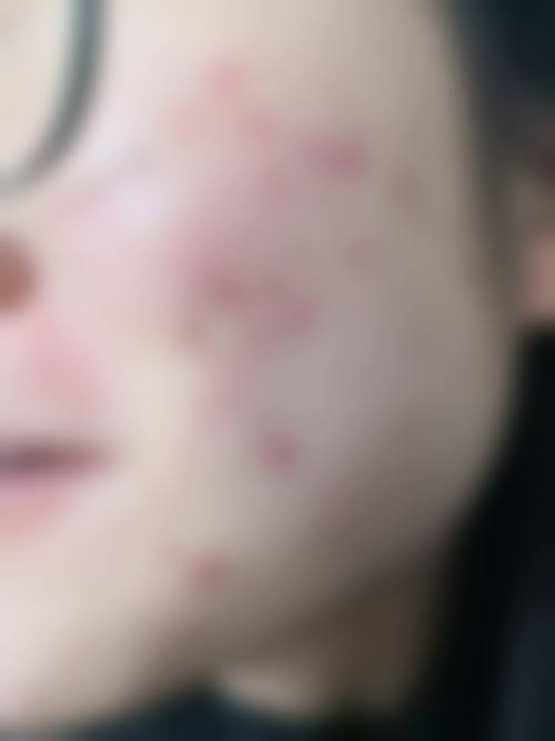 李伦周医生怎么样可靠吗？