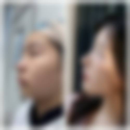 五、新疆乌鲁木齐晗美整形医院实例