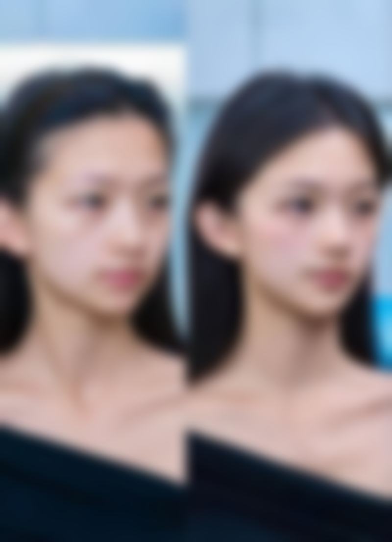 一个双眼皮一个三眼皮处理方式大揭秘：日常观察与基础护理