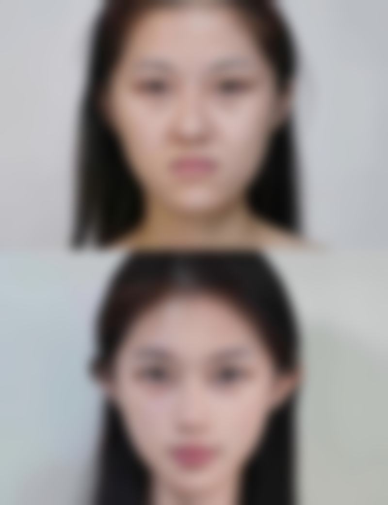 烫伤留下的疤痕能否消掉？揭秘影响消疤的关键因素与有效应对方法 