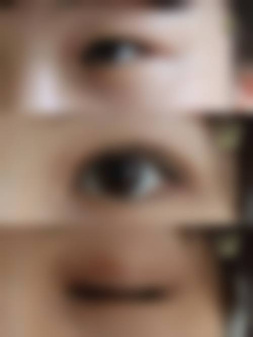 七、日本庆友美容整形医院价格表：（仅供参考）