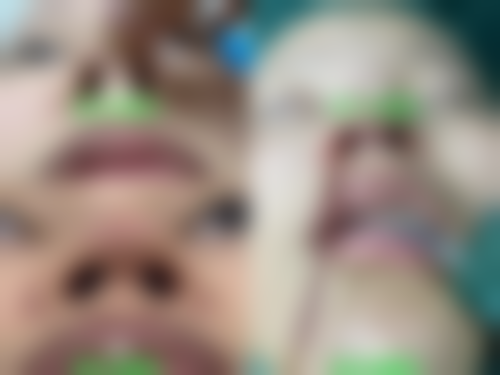 三、宿州灵璧县禅堂乡卫生院整形科基本信息：