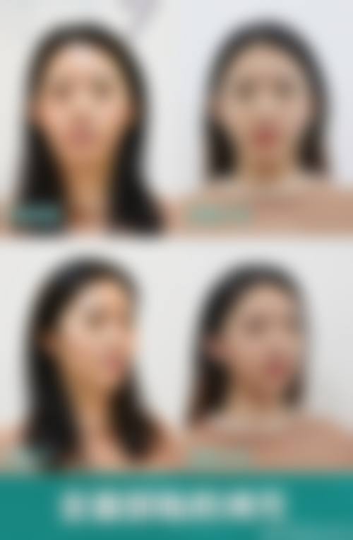 四、淄博星采医疗美容实例