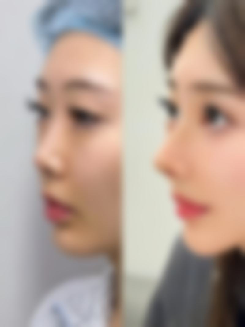 八、宿州灵璧县禅堂乡卫生院整形科真实的顾客评价如下：