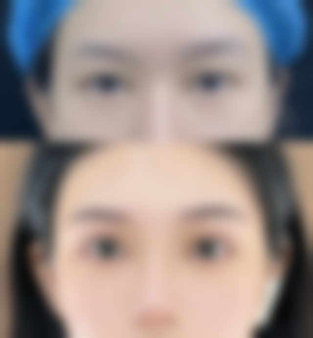 五、宿州灵璧县禅堂乡卫生院整形科实例