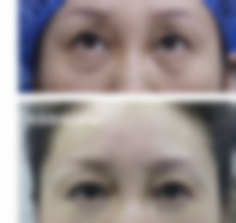 祛斑留下的疤痕怎样修复光滑？中医调理有妙招