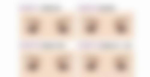 四、南方医 科 大学附属协和医院激光整形美容中 心实例