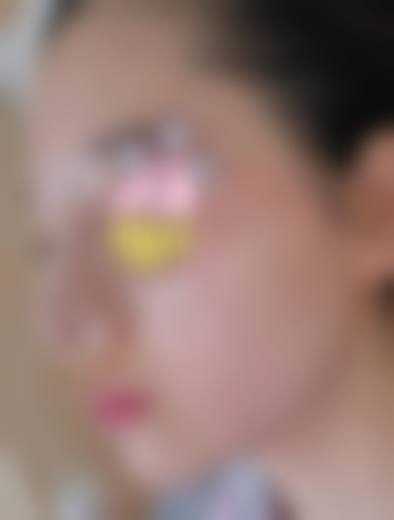 五、泰州韩美医学整形美容医院实例