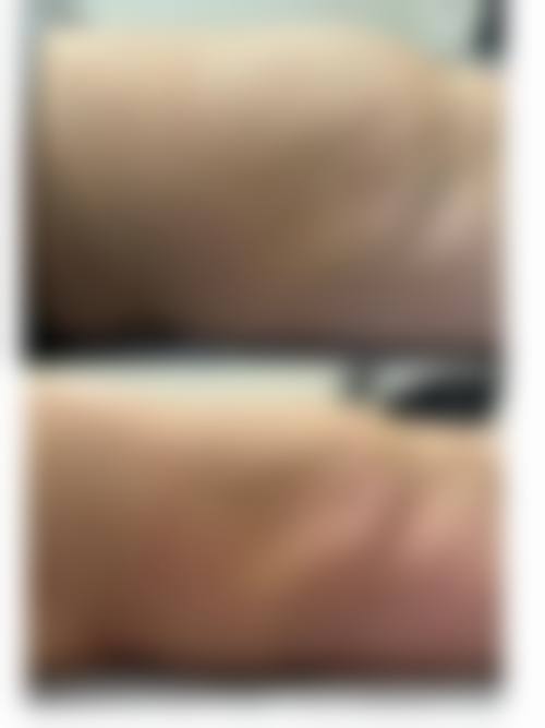 八、百色右江民族医学校附属医院整形科真实的顾客评价如下: